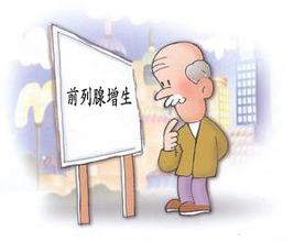 前列腺增生发病时的症状
